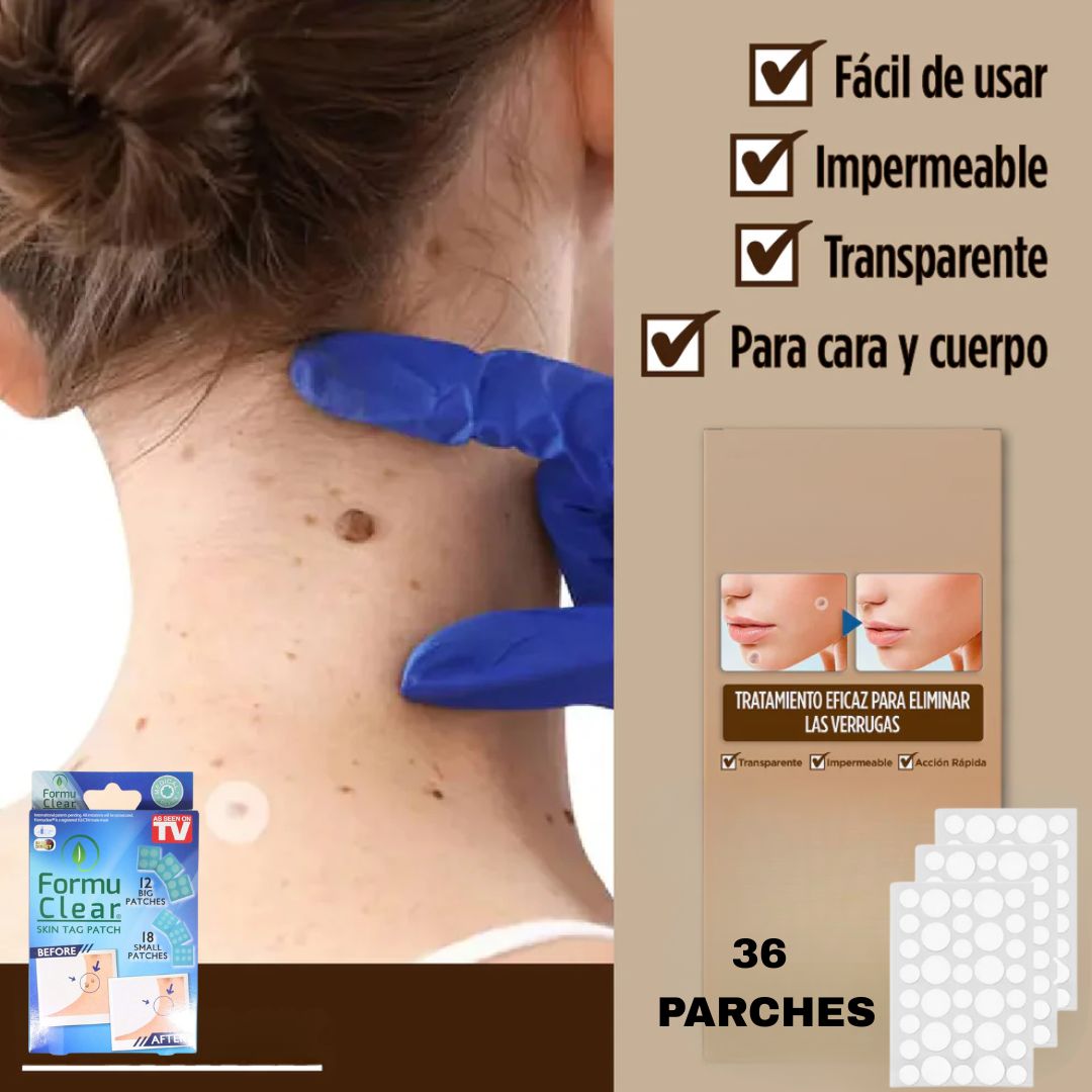 PARCHES PARA VERRUGAS FormuClear™ TRATAMIENTO COMPLETO Y EFICAZ 🔥OFERTA AL 2X1🔥
