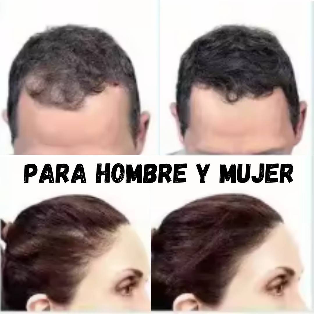 TRATAMIENTO NATURAL DE FIBRAS CAPILARES PARA LA CALVICIE COLOR NEGRO DEXE®🔥OFERTA 2X1🔥