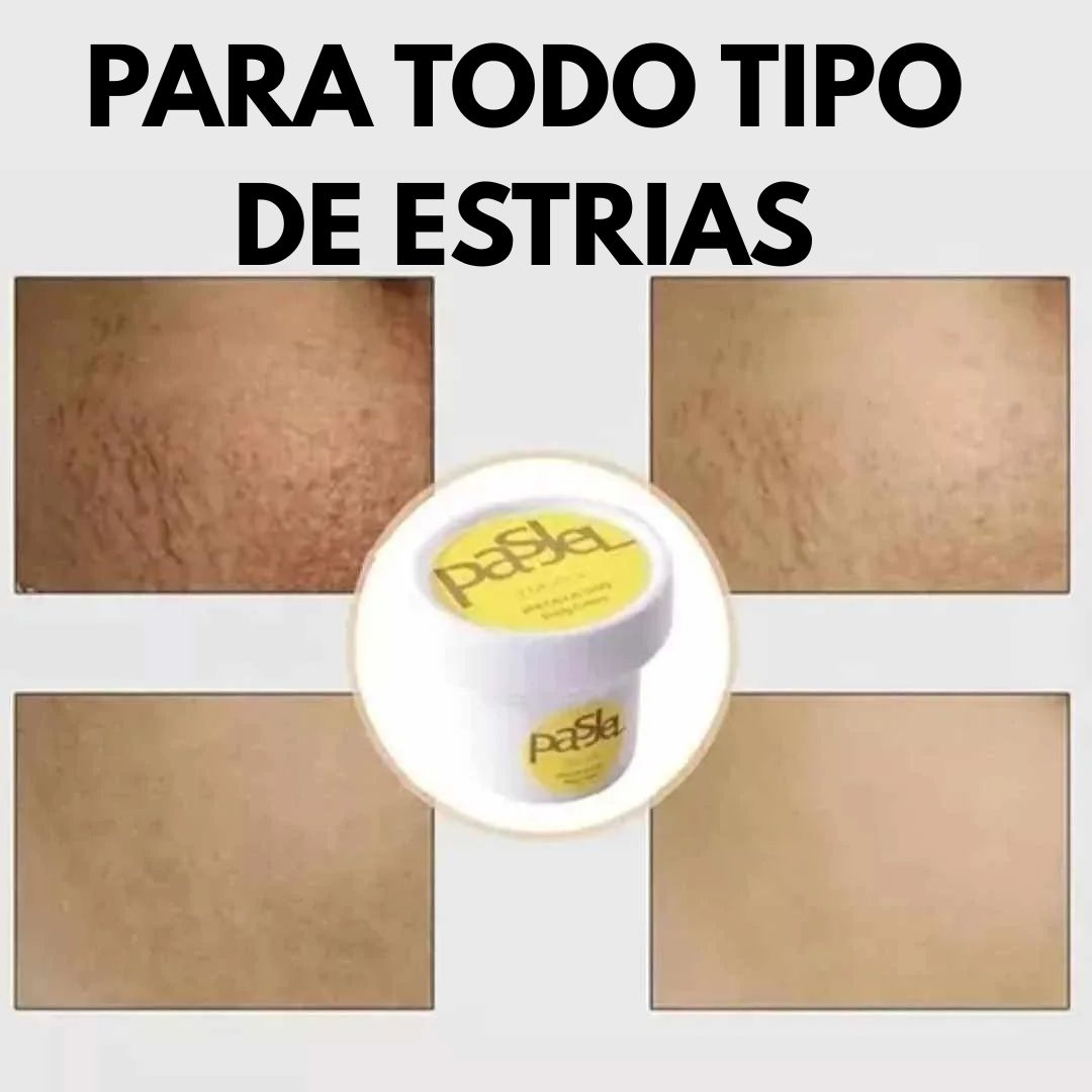 Crema Pasjel® Transforma tu piel y elimina las estrías Súper Oferta 2x1🔥
