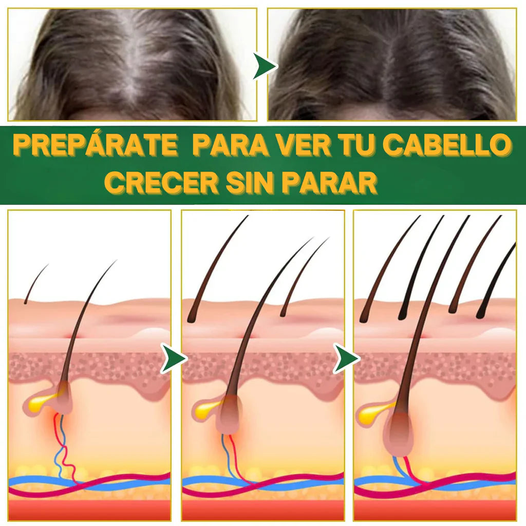 ELIXIR OUHOE PARA EL CRECIMIENTO DEL CABELLO Súper Oferta 2x1🔥