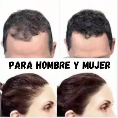 TRATAMIENTO NATURAL DE FIBRAS CAPILARES PARA LA CALVICIE COLOR NEGRO DEXE®🔥OFERTA 2X1🔥