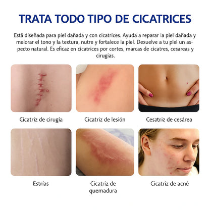 Crema Para Cicatrices Profundas ELAIMEI ORIGINAL® 🔥60% de Descuento🔥 Elimina cicatrices de forma segura✨