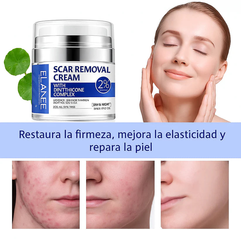 Crema Para Cicatrices Profundas ELAIMEI ORIGINAL® 🔥60% de Descuento🔥 Elimina cicatrices de forma segura✨