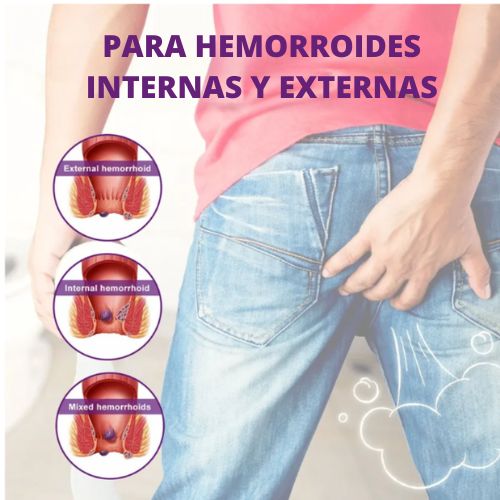 Spray Para Hemorroides Alivio Instantáneo ¡Recupera tu Comodidad y Bienestar Hoy Mismo! Con 60% Descuento🔥