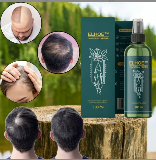 ELIXIR OUHOE PARA EL CRECIMIENTO DEL CABELLO Súper Oferta 2x1🔥