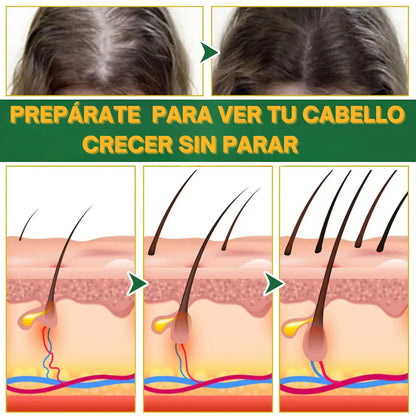 ELIXIR OUHOE PARA EL CRECIMIENTO DEL CABELLO Súper Oferta 2x1🔥