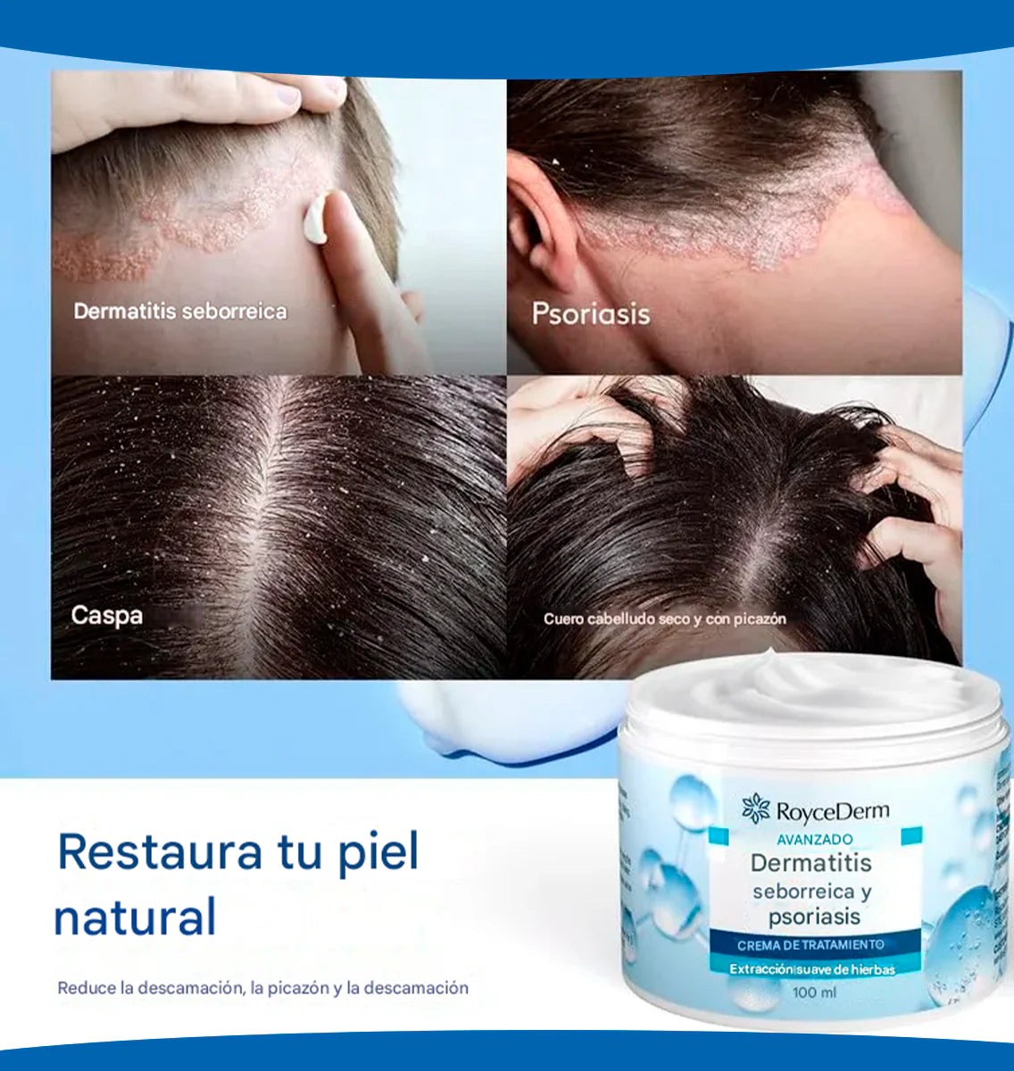 Crema dermatitis Royce Derm ® 🔥60% de Descuento