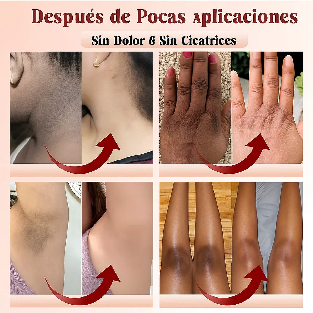 Exfoliante PHANSTA® Elimina manchas, puntos negros zonas oscuras🔥60% de Descuento🔥