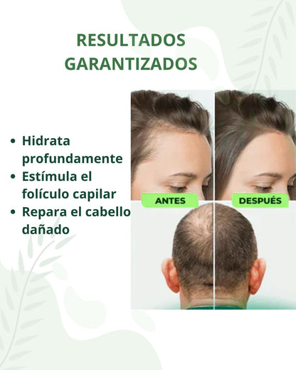 Spray Para Crecimiento De Cabello y Bello Rápido OUHOE® ORIGINAL 🔥Lleva 2 y paga 1🔥.