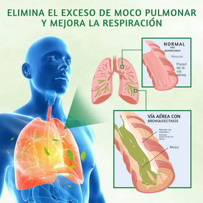 Spray hierbas limpia pulmones 🔥60% de Descuento🔥
